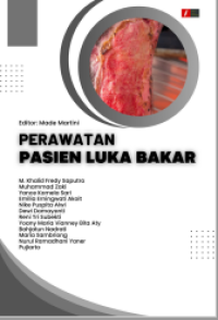 e-book Perawatan Luka Bakar